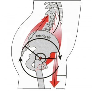 anterior-pelvic-tilt2